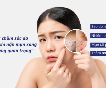 BÍ QUYẾT CHĂM SÓC DA SAU NẶN MỤN NGỪA THÂM VÀ SẸO